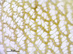 Obraz mikroskopowy komórek listka od strony grzbietowej